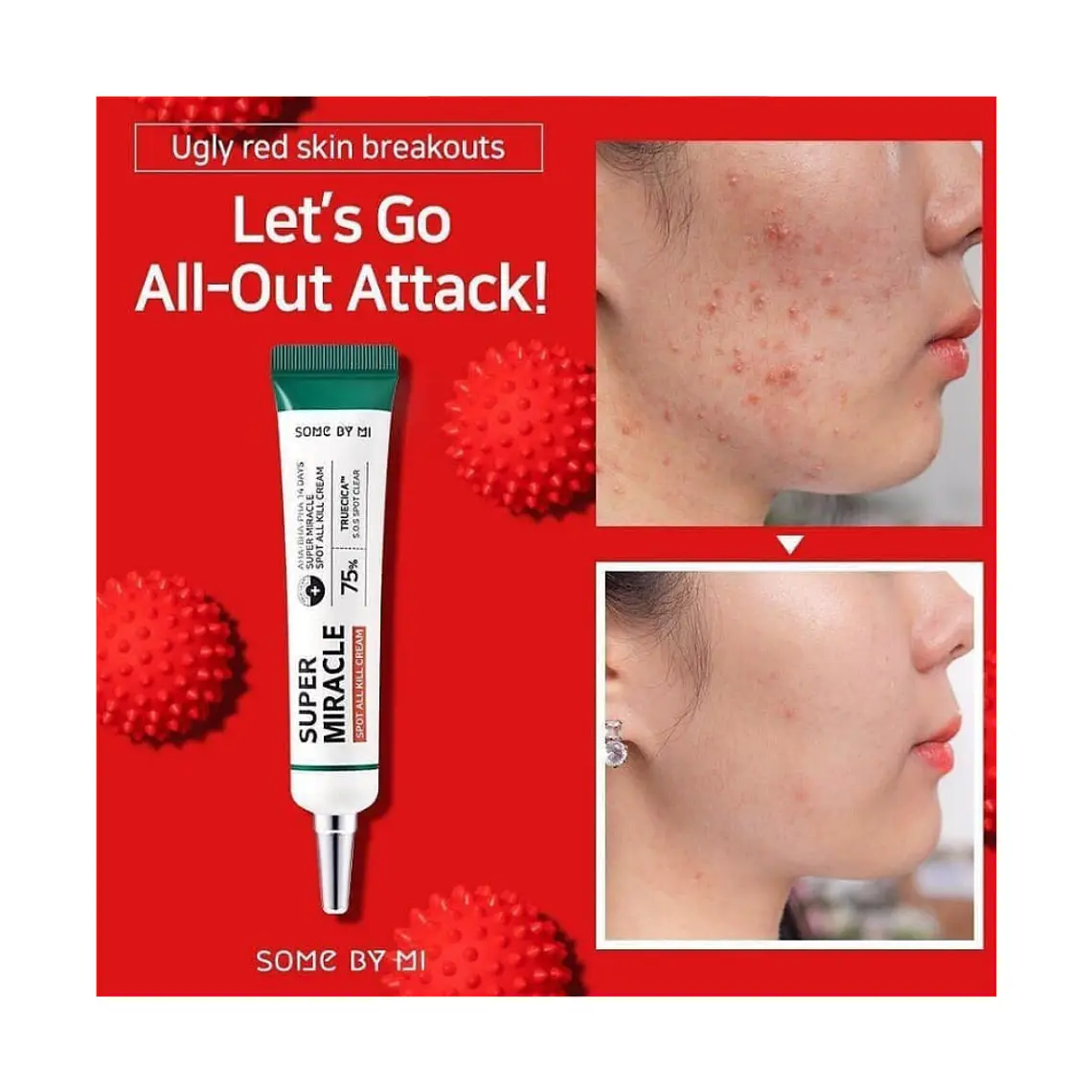 AHA.BHA.PHA 14 Days Super Miracle Spot All Kill Cream – SOME BY MI 3