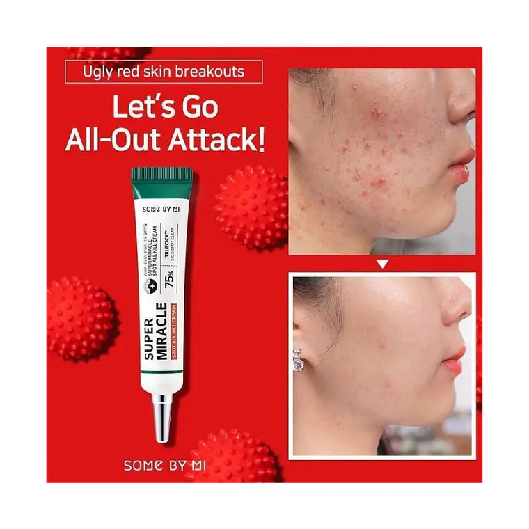 AHA.BHA.PHA 14 Days Super Miracle Spot All Kill Cream – SOME BY MI 3