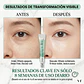 PDRN Reedle Shot Eye Lifter  VT Cosmetics - Miniatura 5