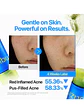 Numbuzin No. 0 Zero Blemish Clarifying 2% Sulfur Cleansing Foam 150 ml - Miniatura 3