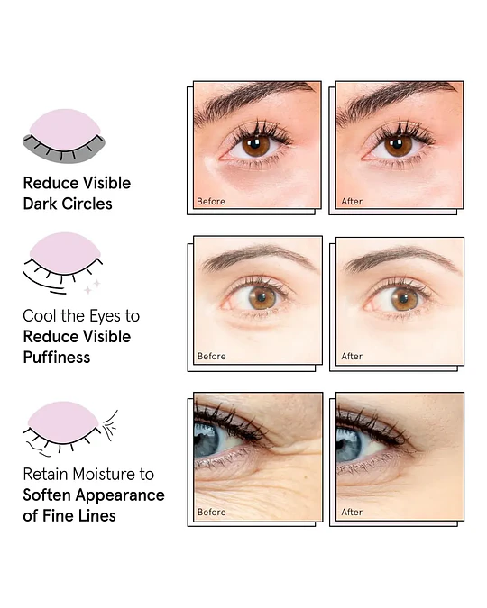 SET 3 Parches Para Ojeras Grace & Stella 