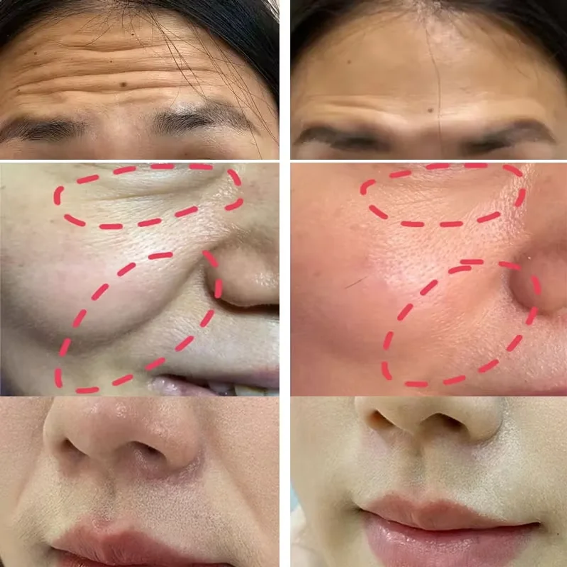 Barra de bálsamo multiusos con colágeno para eliminar arrugas 2