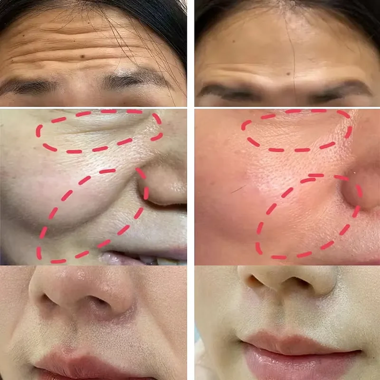 Barra de bálsamo multiusos con colágeno para eliminar arrugas 2