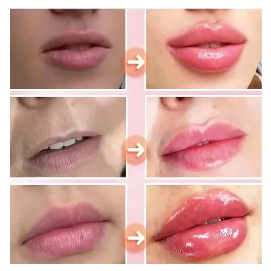 Brillo voluminizador de labios instantáneo, reduce las líneas de expresión 2