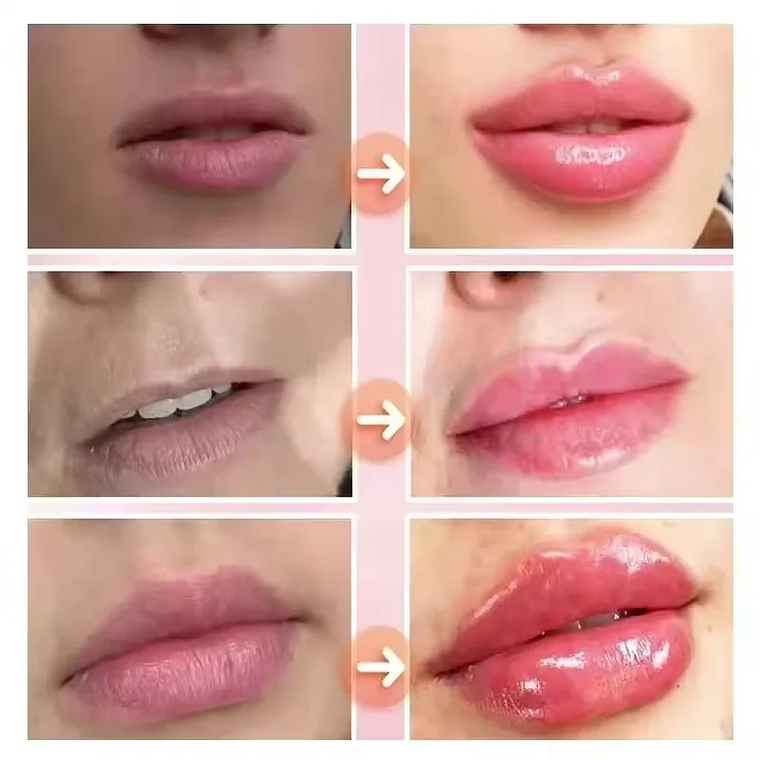 Brillo voluminizador de labios instantáneo, reduce las líneas de expresión 2