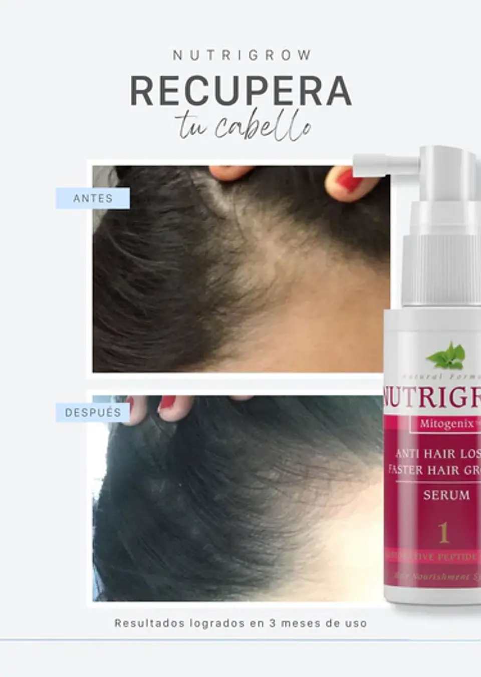 SERUM NUTRIGROW ¿Tu cabello se cae más de lo normal? ¿Lo notas débil, fino o con poco crecimiento? 3