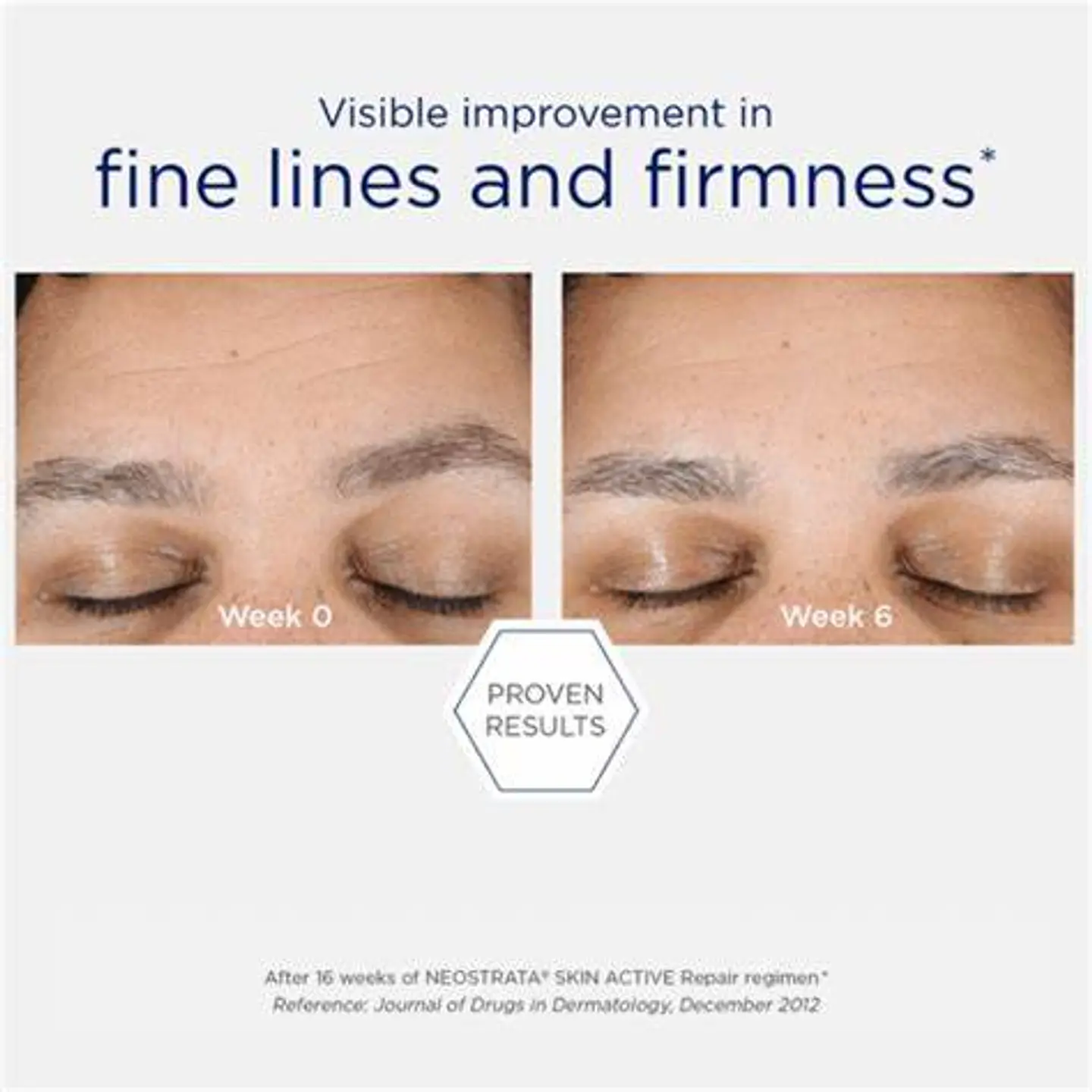 Skin Active Hyaluronic Luminous Lift ¿Notas que tu piel se ve opaca, con líneas finas o falta de firmeza? 4