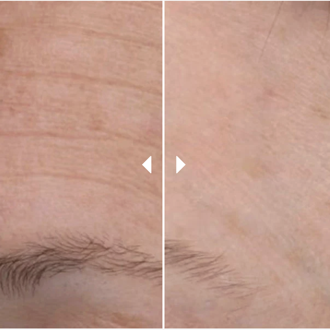 Skin Active Exfoliating Wash 125 ml ¿Tu piel luce opaca, con textura irregular o signos de envejecimiento? 2