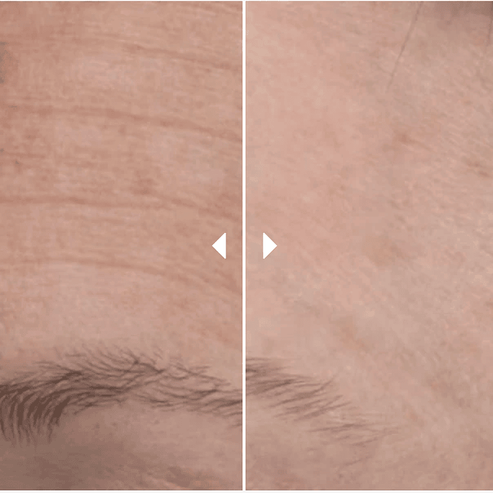 Skin Active Exfoliating Wash 125 ml ¿Tu piel luce opaca, con textura irregular o signos de envejecimiento? 2