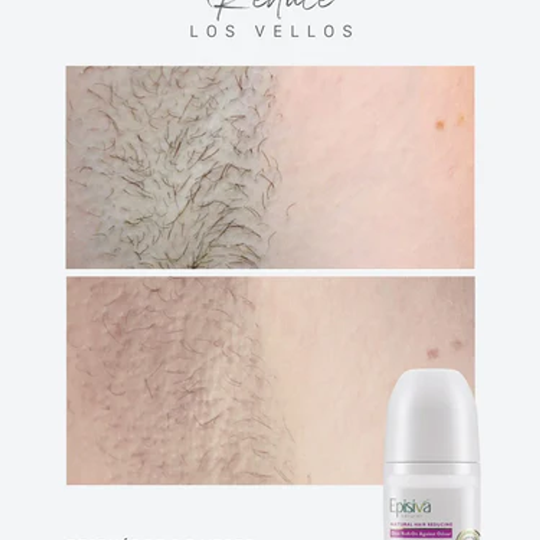 DESODORANTE EPISIVA ¿Te cansa depilarte las axilas constantemente porque el vello vuelve rápido y más grueso? 2