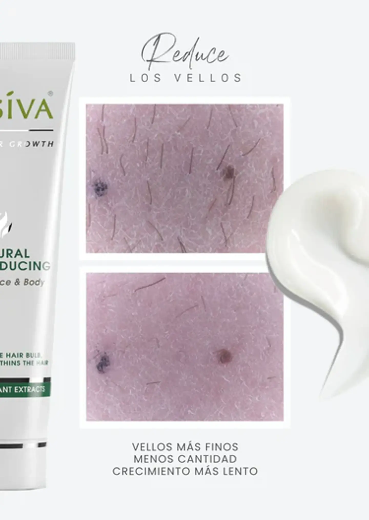 Episiva Crema reductora de vello ¿Cansada(o) de depilarte constantemente, sufrir irritación o ver cómo el vello vuelve a crecer rápido y más grueso? 3