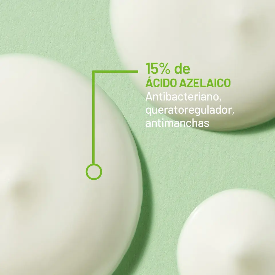 Teen Derm A.Z 15% Ácido Azelaico | Tratamiento para Acné y Marcas | ISISPHARMA 2