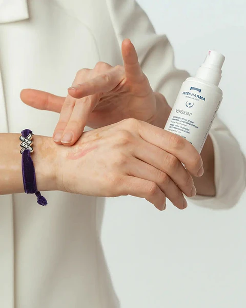 Vitiskin Isispharma – Hidrogel Regulador para Déficits de Pigmentación