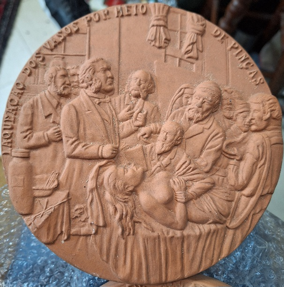 Medalha, Laqueação dos vasos 3