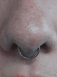Septum perforación  - Miniatura 1