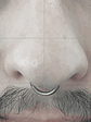 Septum perforación  - Miniatura 2