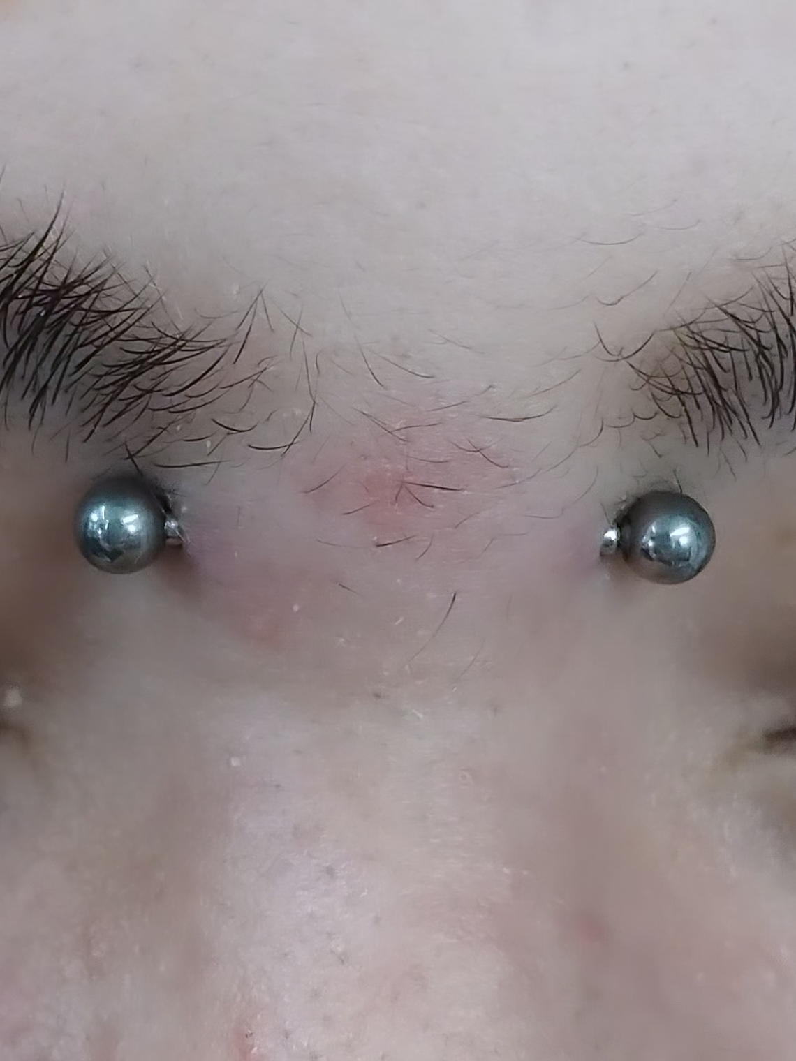 Bridge perforación  1