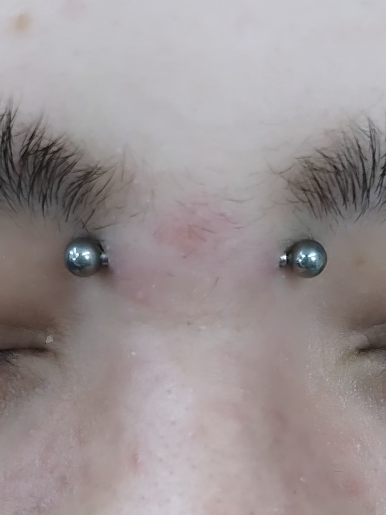 Bridge perforación  2