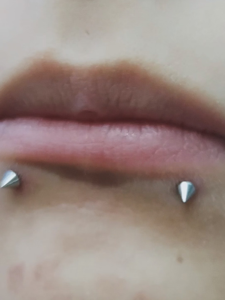 Perforación snake bite , (esferas o puntas 3m) 4