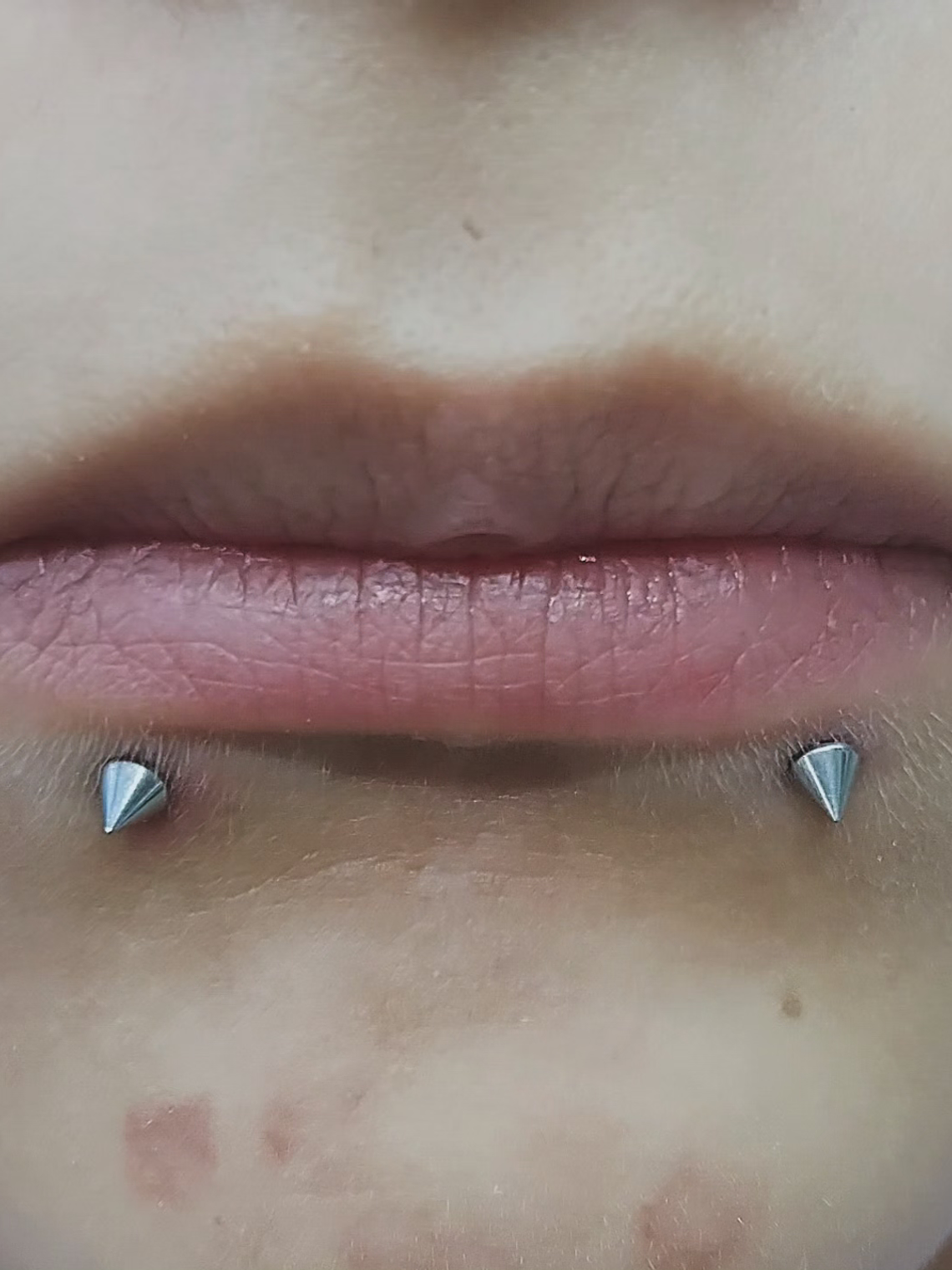 Perforación snake bite , (esferas o puntas 3m) 5