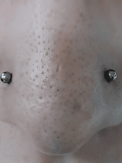 Perforación Doble nostril (simetría) titanio grado implantes (16g)
