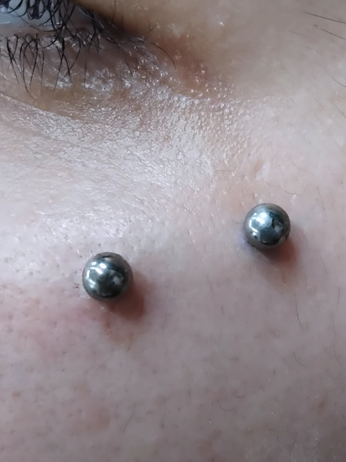 Surface en titanio grado implante con esferas. 14g  2