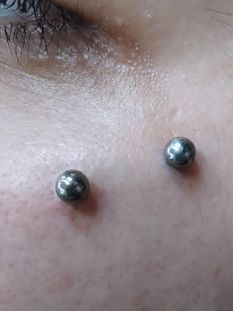 Surface en titanio grado implante con esferas. 14g  2