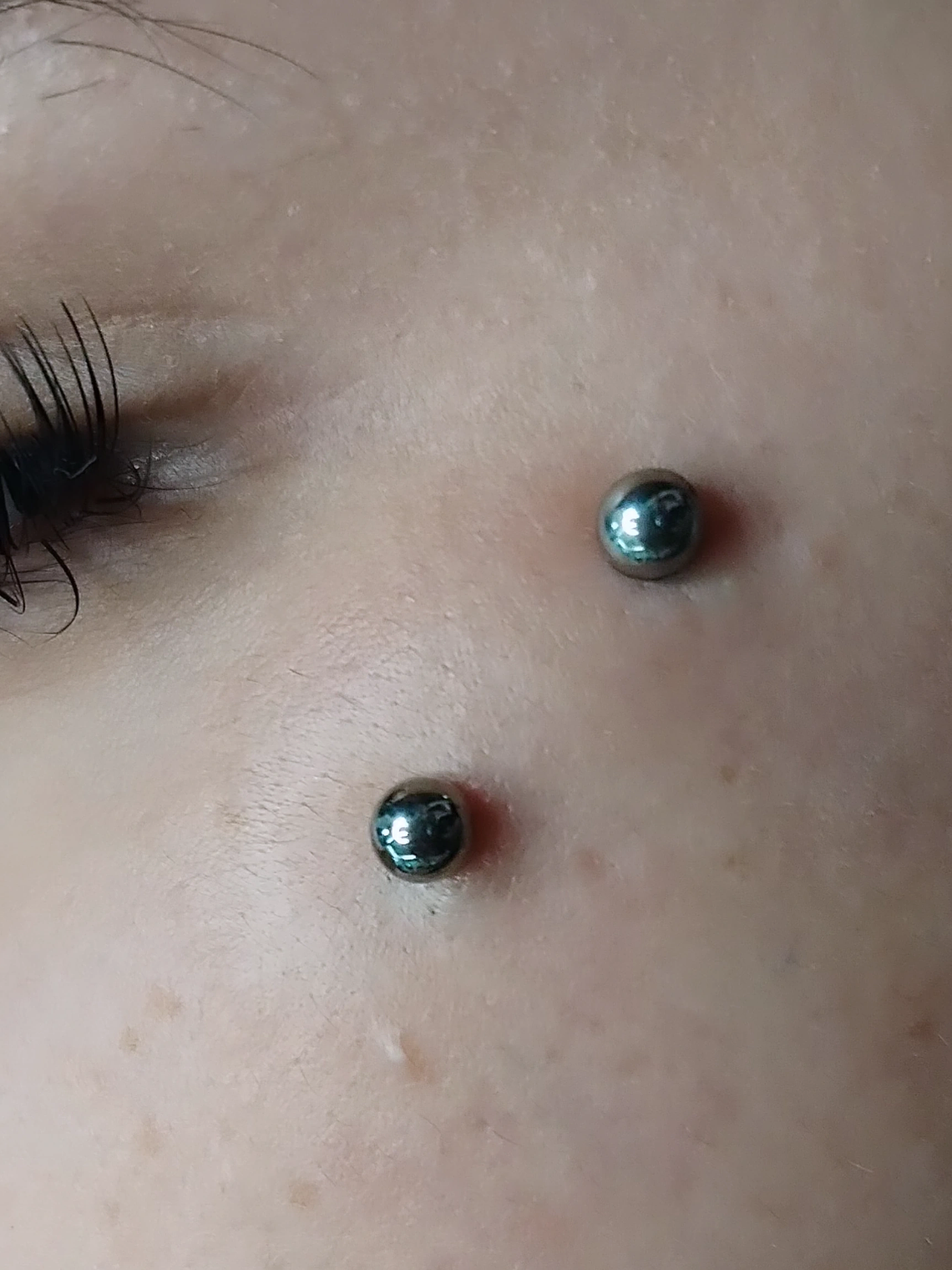 Surface en titanio grado implante con esferas. 14g  1