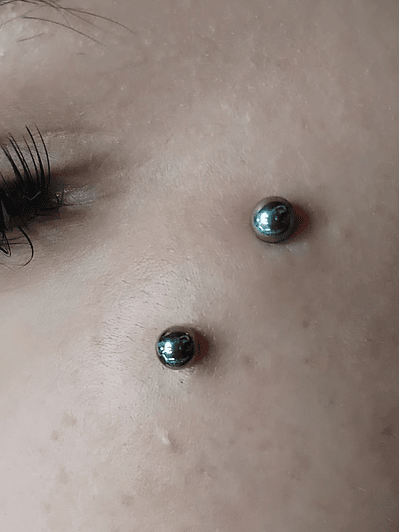 Surface en titanio grado implante con esferas. 14g 