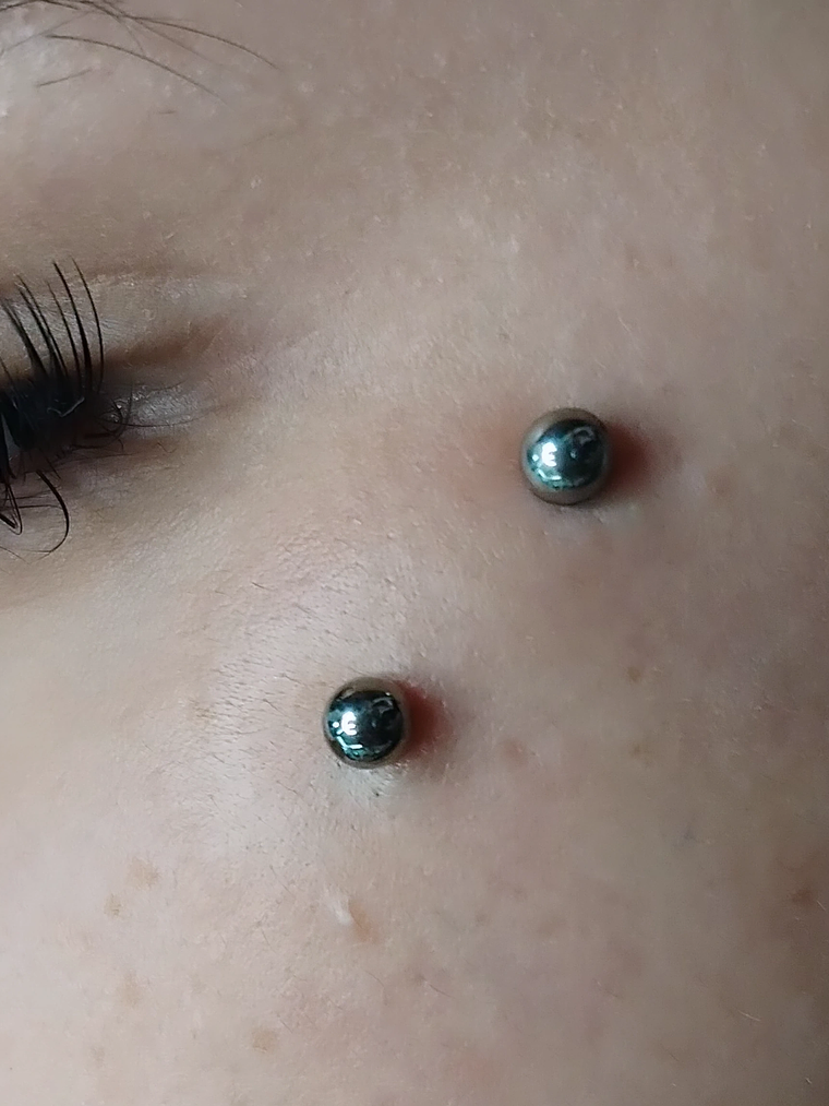 Surface en titanio grado implante con esferas. 14g  1