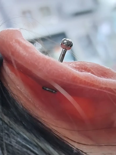 Perforación helix 