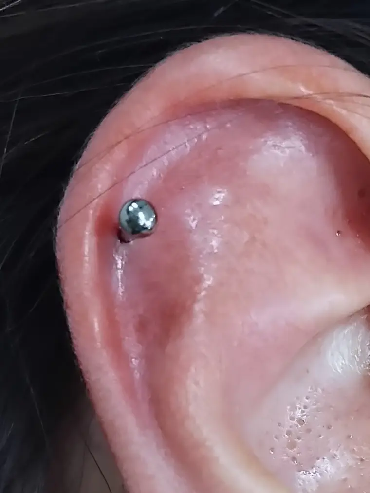 Perforación helix  2