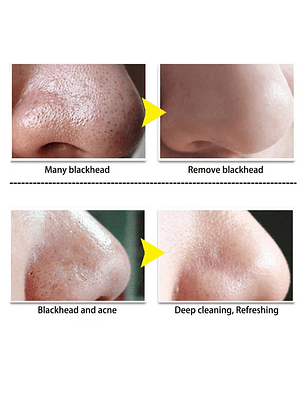 Crema koreana puntos negros 