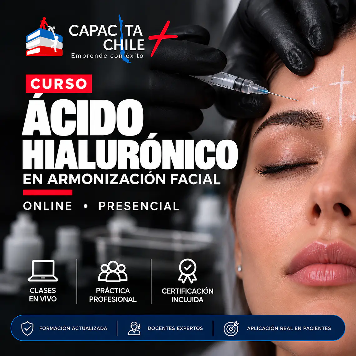 Curso de Ácido Hialurónico en Armonización Facial – Teórico Práctico 1