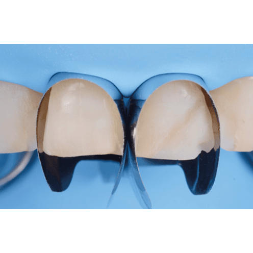 MATRIZ UNICA ANTERIOR 12 UNIDADES 3