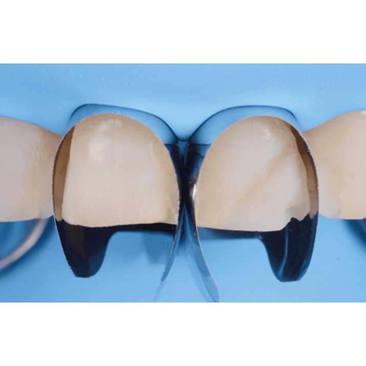 MATRIZ UNICA ANTERIOR 12 UNIDADES 3