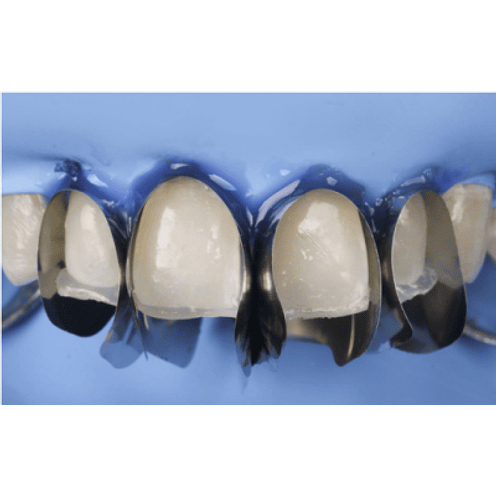 MATRIZ ÚNICA ANTERIOR MINI DEEP 12 UNID. 3