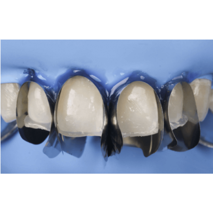 MATRIZ ÚNICA ANTERIOR MINI DEEP 12 UNID. 3