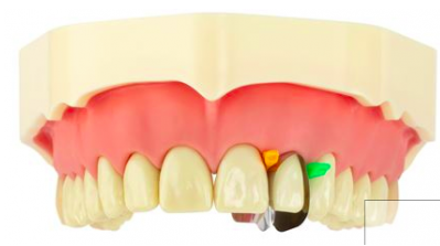 MATRIZ ÚNICA ANTERIOR MINI DEEP 12 UNID. 4
