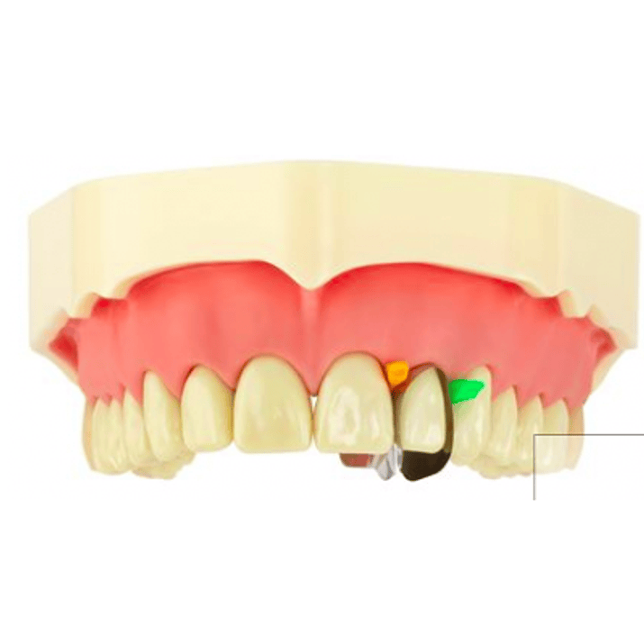 MATRIZ ÚNICA ANTERIOR MINI DEEP 12 UNID. 4