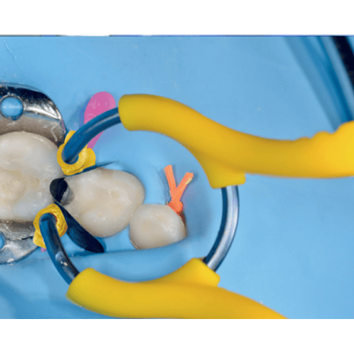 MY CLIP JUNIOR 1 ANILLO + 1 PAR TINES JUNIOR 3