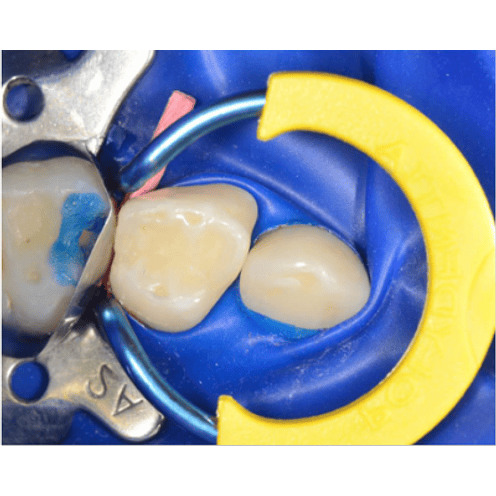 MY RING JUNIOR 1 ANILLO  + 1 PAR TIENE JUNIOR 2