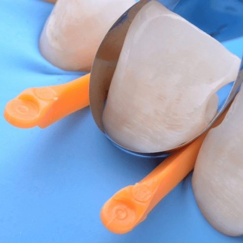 MY WEDGE CUÑAS INTERDENTALES PLÁSTICAS EN V SURTIDAS 2