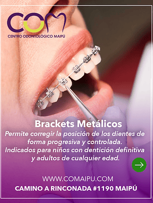 brackets metalicos