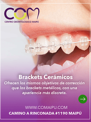 brackets ceramicos