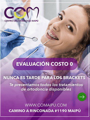 frenillos brackets