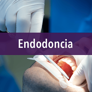 Endodoncia
