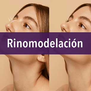 rinomodelación