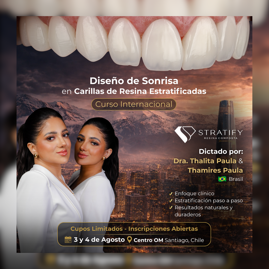 Stratify Internacional: Diseño de Sonrisa en Carillas de Resina Estratificadas 1