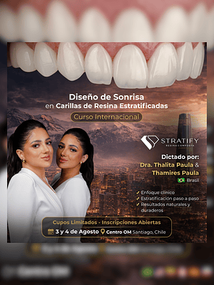 Stratify Internacional: Diseño de Sonrisa en Carillas de Resina Estratificadas